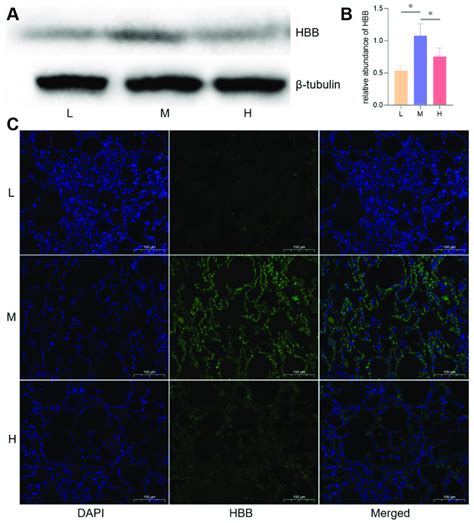 WB and immunofluorescence analysis of the key protein, HBB. Changes in... | Download Scientific ...