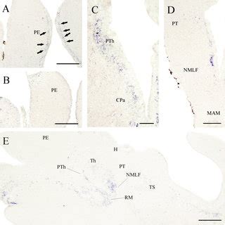 Photomicrographs illustrating the distribution of the Y1-expressing... | Download Scientific Diagram