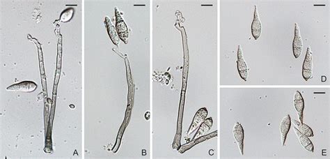 Pyricularia oryzae - An E-monograph of the Fungal Order Magnaporthales: Taxonomy, Molecular ...