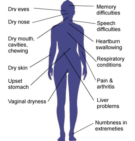 Spotlight On: My Life With Sjogren's Syndrome