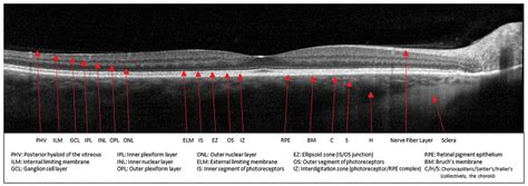 Take Macular OCT to a Whole New Layer