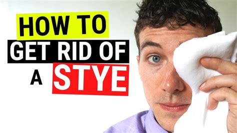 How To Get Rid Of Styes In A Day - Flatdisk24