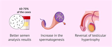 Fertility success after varicocele surgery