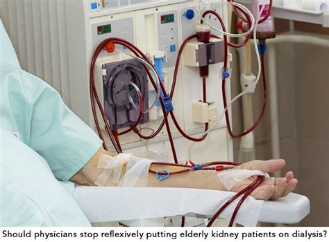 When Dialysis Is the Wrong Approach to End-Stage Kidney Disease ...