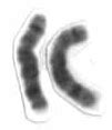 Chromosome 8 (human) - Wikipedia