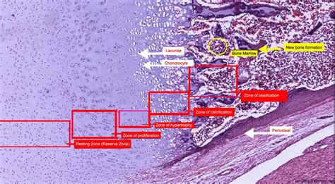 epiphyseal-plate-slide-labelled-histology | Online Homework Help ...