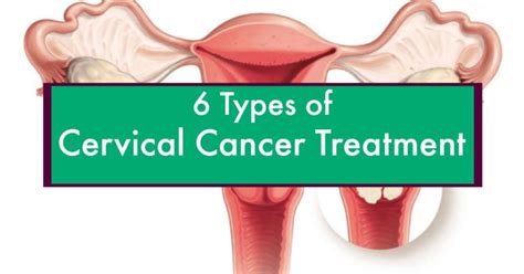 6 Types of Cervical Cancer Treatment | Cervical Cancer Treatment