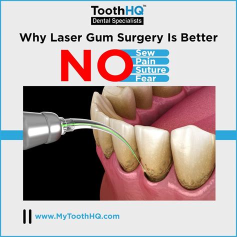 Laser Gum Surgery Vs. Traditional Surgery - ToothHQ Dental Specialists