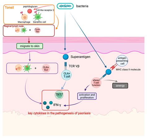 IJMS | Free Full-Text | Roles of Infection in Psoriasis