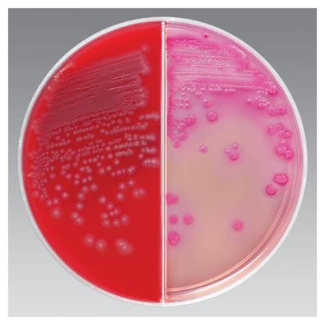 Thermo Scientific Blood Agar (TSA with 5% Sheep Blood) / MacConkey Agar | Fisher Scientific