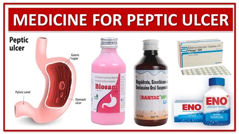 Treatment Of Peptic Ulcer Medicine Use To Treat Pepti - vrogue.co