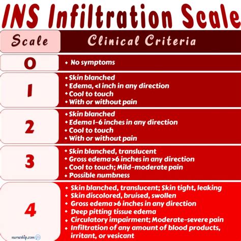 Extravasation vs Infiltration vs Phlebitis: Local Complications of Intravenous (IV) Therapy ...