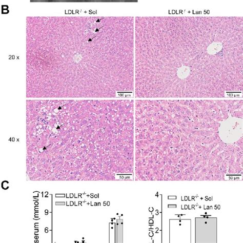 CYP1A induction reversed hepatic lipidosis of LDLR knockout rats. (A ...