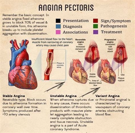 What is Angina? Symptoms, Risk factors, Causes & Treatment.