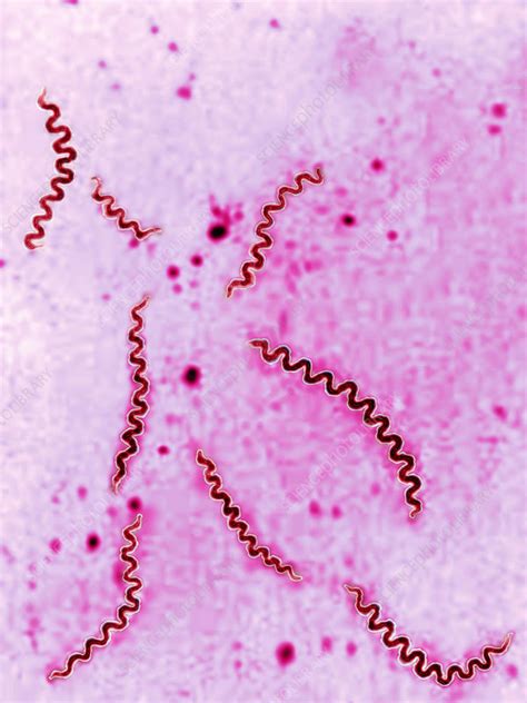 Treponema bacteria, LM - Stock Image - C028/2805 - Science Photo Library