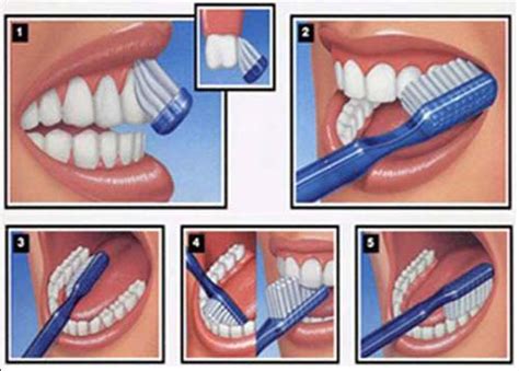 Manual vs. Electric Toothbrush | Drummoyne Dental Practice