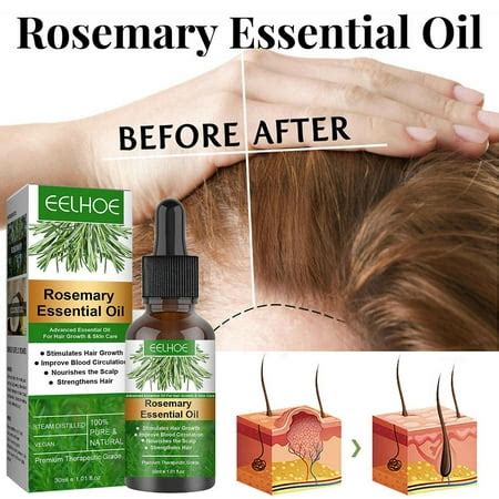 30ml Rosemary Hair Oil Nourishment Scalp Stimulates Hair Growth Hair ...