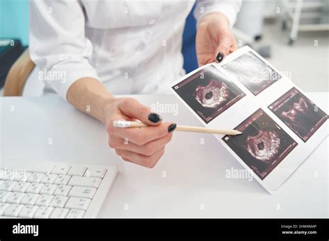 Doctor demonstrating first trimester ultrasound images of her patient Stock Photo - Alamy