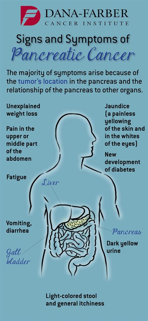 Pancreatic Cancer: What are the Signs and Symptoms? | Dana-Farber Cancer Institute