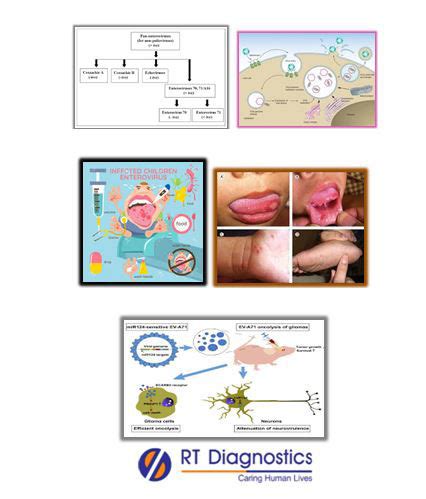 Entero Virus (RNA Quantitative RT - PCR) | RT Diagnostics