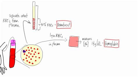 Anemia: Basic lab tests - hematocrit, hemoglobin, reticulocyte, MCV, morphology - YouTube