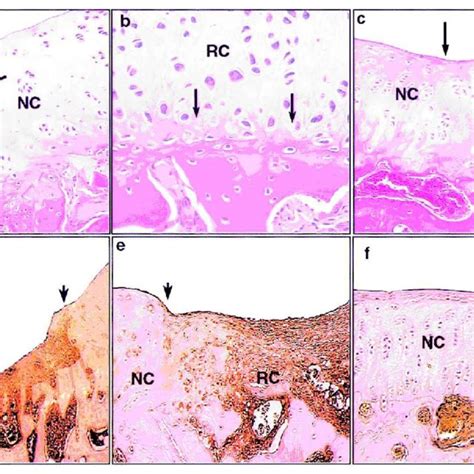 Regenerated hyaline cartilage. Regenerated hyaline cartilage was... | Download Scientific Diagram