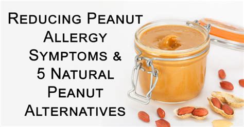 Reducing Peanut Allergy Symptoms & 5 Natural Peanut Alternatives ...