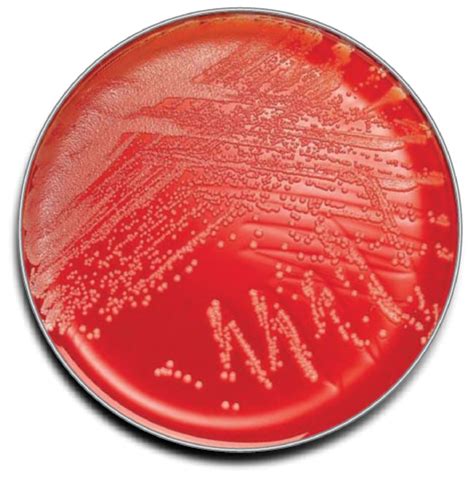 BD BBL Prepared Plated Media: Columbia Agar with 5% Sheep Blood 100/Pk.:Microbiological | Fisher ...