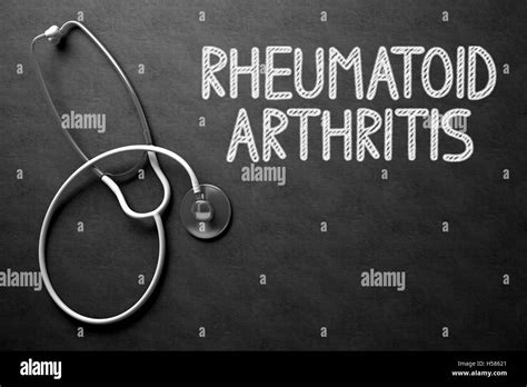 Rheumatoid Arthritis Hands X Ray