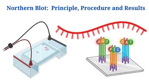 Northern Blot: Overview, Principle, Procedure and Results - PhD Nest