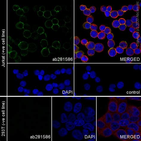 Recombinant Anti-CD45 antibody [RM1007] (ab281586) | Abcam