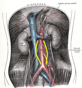 Abdominal aortic aneurysm overview - wikidoc