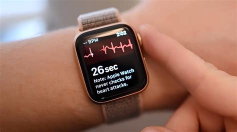 Apple Watch Comes To The Rescue Again, Its ECG Feature Helps Save The ...