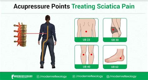 Acupressure Points for Sciatica Pain | Acupressuur