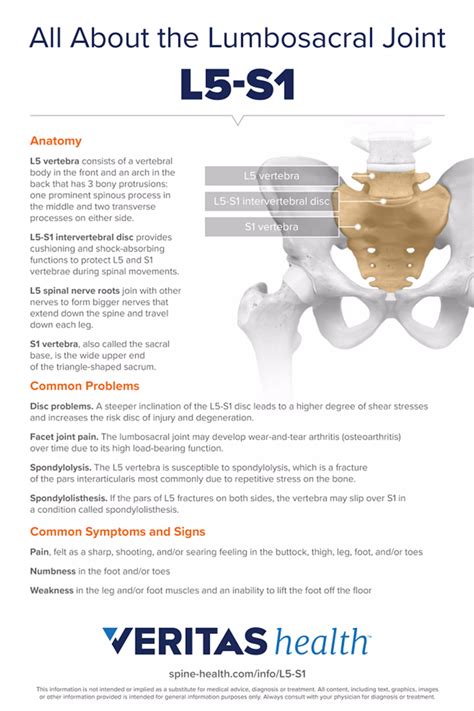 L5 S1 Disc Degeneration Symptoms