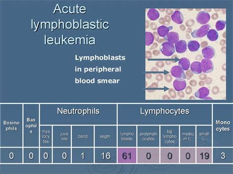 WBC pathology. (Subject 11) - презентация онлайн