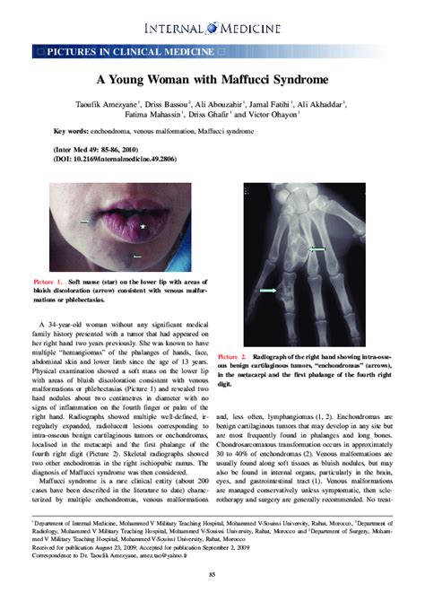 (PDF) A Young Woman with Maffucci Syndrome | T. Amezyane - Academia.edu