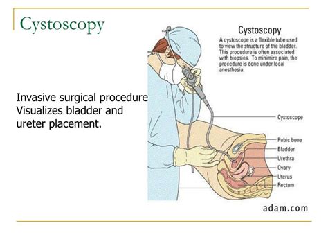 PPT - Genitourinary Disorders PowerPoint Presentation, free download - ID:4773133