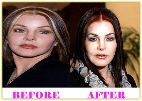 Priscilla Presley Plastic Surgery Before And After #PriscillaPresleyPlasticSurgery… | Priscilla ...