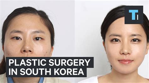 Plastic surgery in South Korea - Oasis Medical Aesthetics