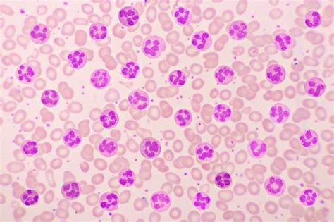 Absolute Eosinophil Count Test - Medical Lab Technician Online Learning Platform