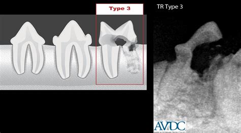 Tooth Resorption Cats Types - Cat Meme Stock Pictures and Photos