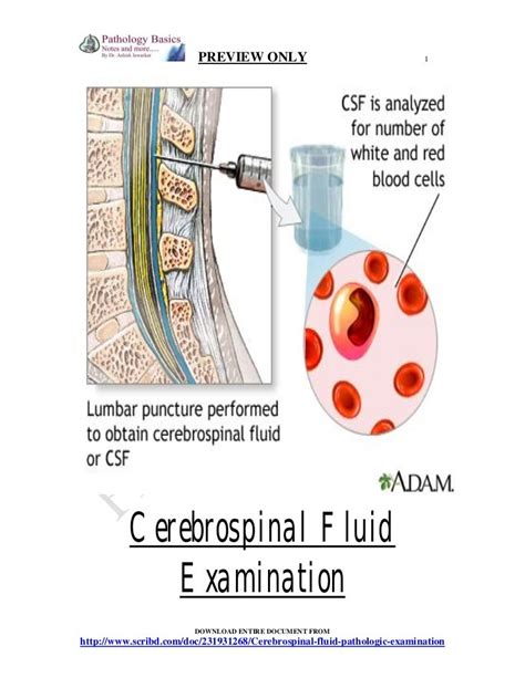 CSF - Cerebrospinal fluid examination - from tapping to pathological