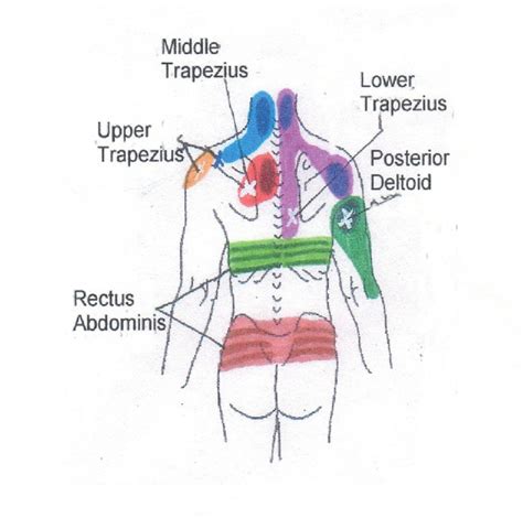 Neck to Buttocks, Front and Rear, Trigger Point Chart 5 © Copyright American Academy of Manual ...