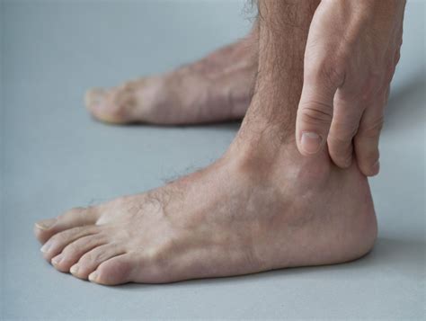 Tendonitis of the Foot and Ankle