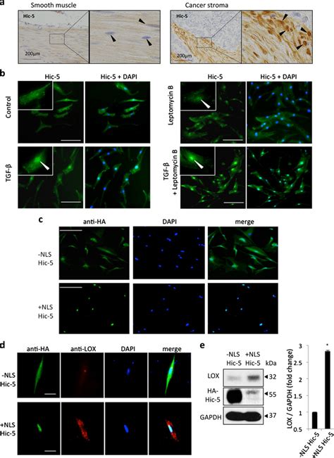 Nuclear localized Hic-5 induced the expression of LOX. a Representative ...