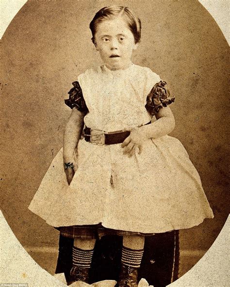 Photos of disabled people in the Victorian era | Strange history, John ...