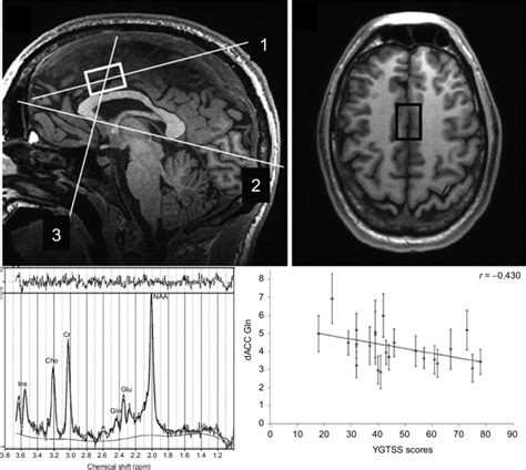 3. Relationship between proton magnetic resonance spectroscopy (MRS)... | Download Scientific ...