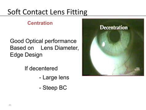 Soft Contact Lens Fitting