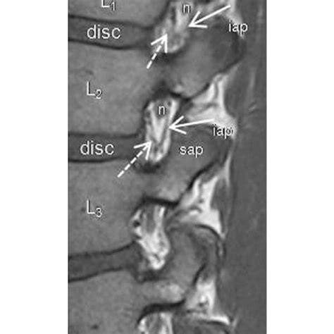 Parameters for MRI technigues | Download Table